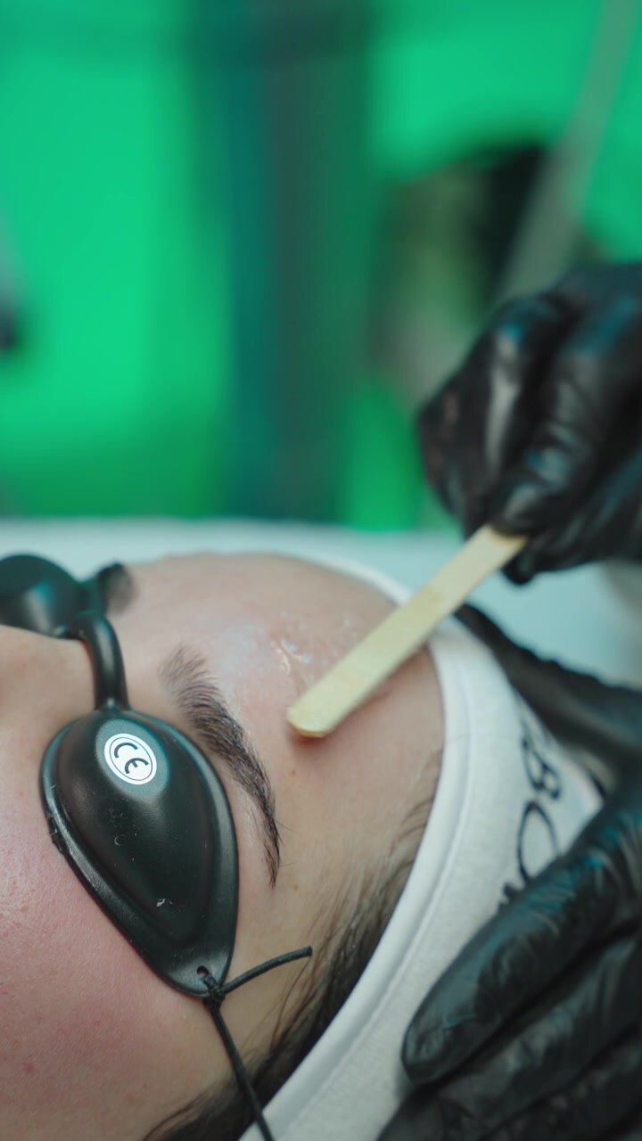Kühlgel wird auf die Stirn eines Patienten aufgetragen vor einer Laserbehandlung zur Pigment- oder Haarentfernung in einem professionellen klinischen Umfeld