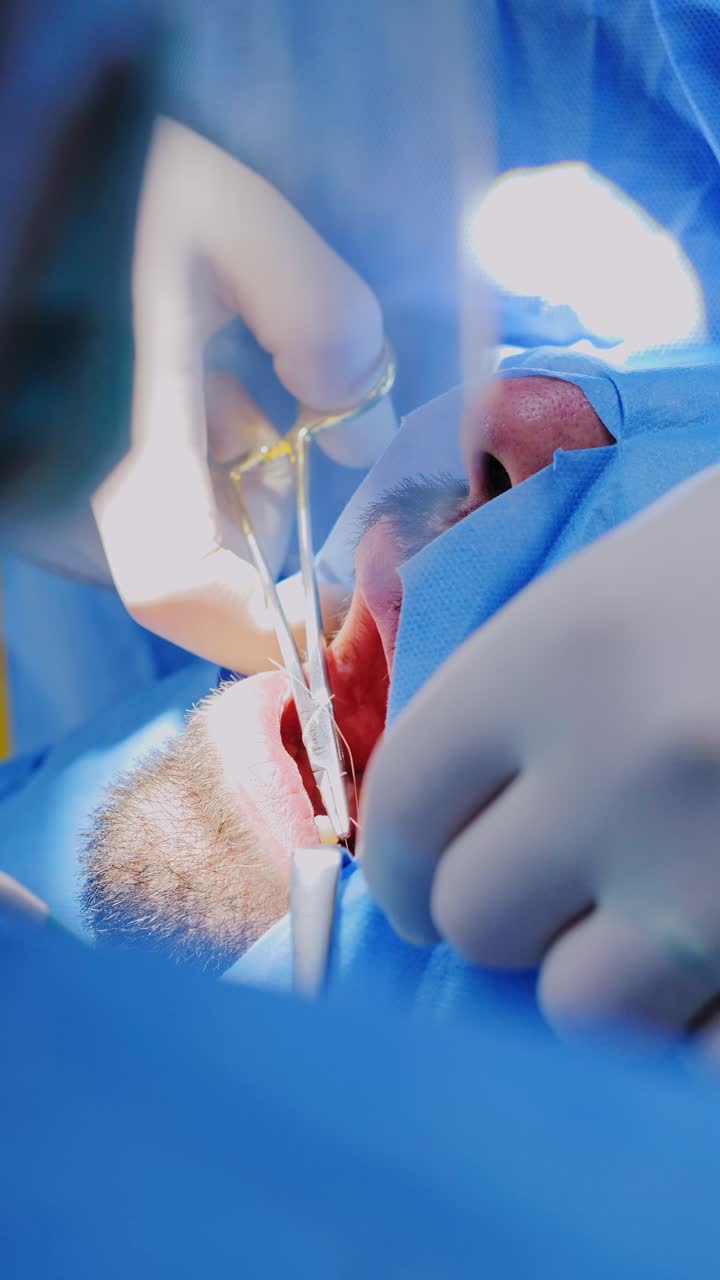 Hands in gloves sew soft gum tissue after tooth implant during oral surgery