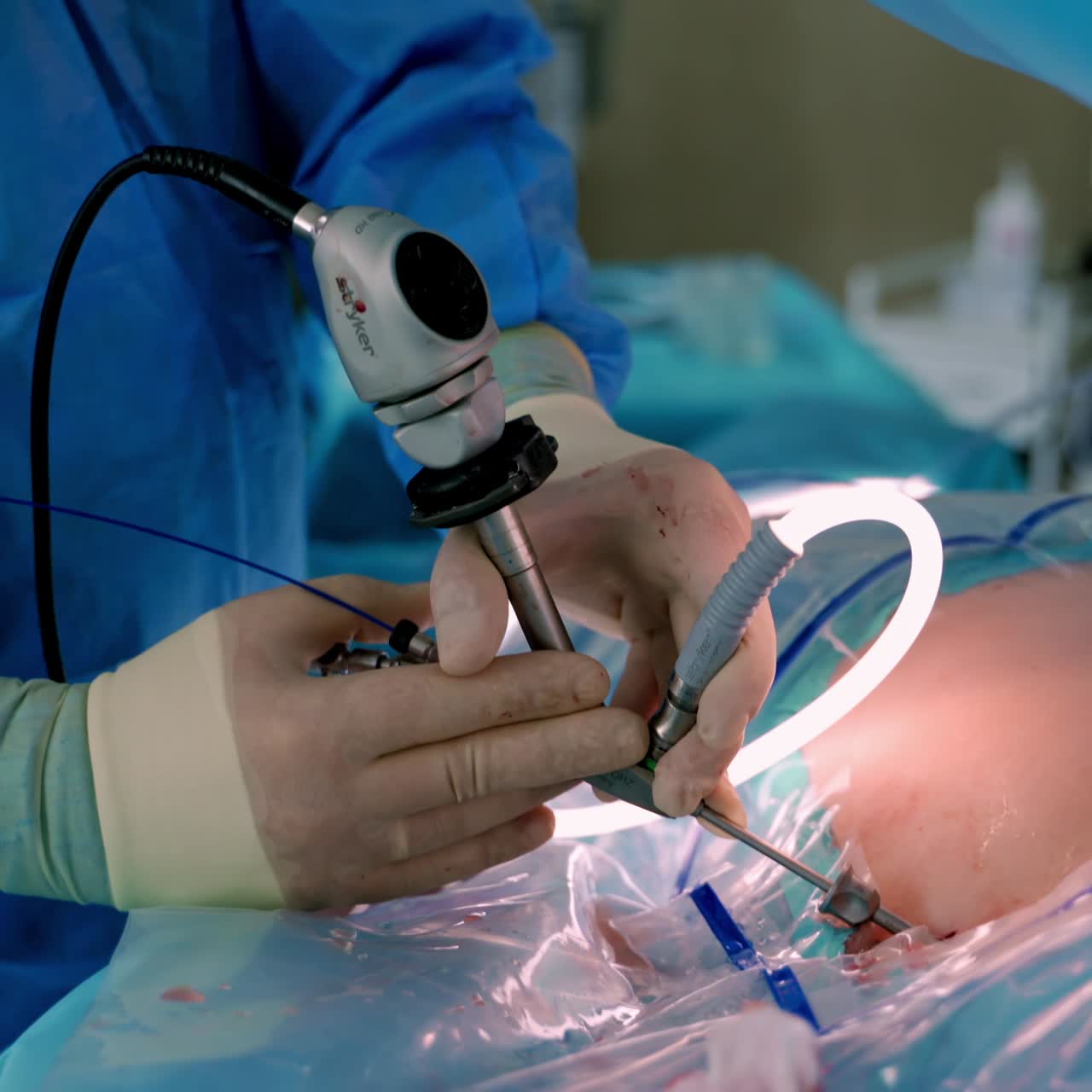 Surgeon in operation room. Working with surgical instruments. Modern equipment in operating room