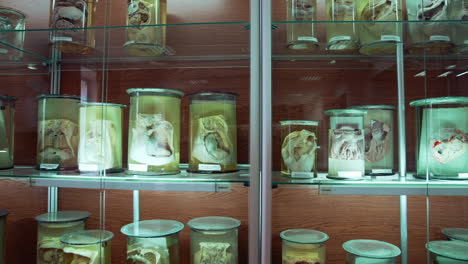 large collection of human organs in anatomical museum. different parts of internal organs preserved in formaldehyde on shelves. scientific education.