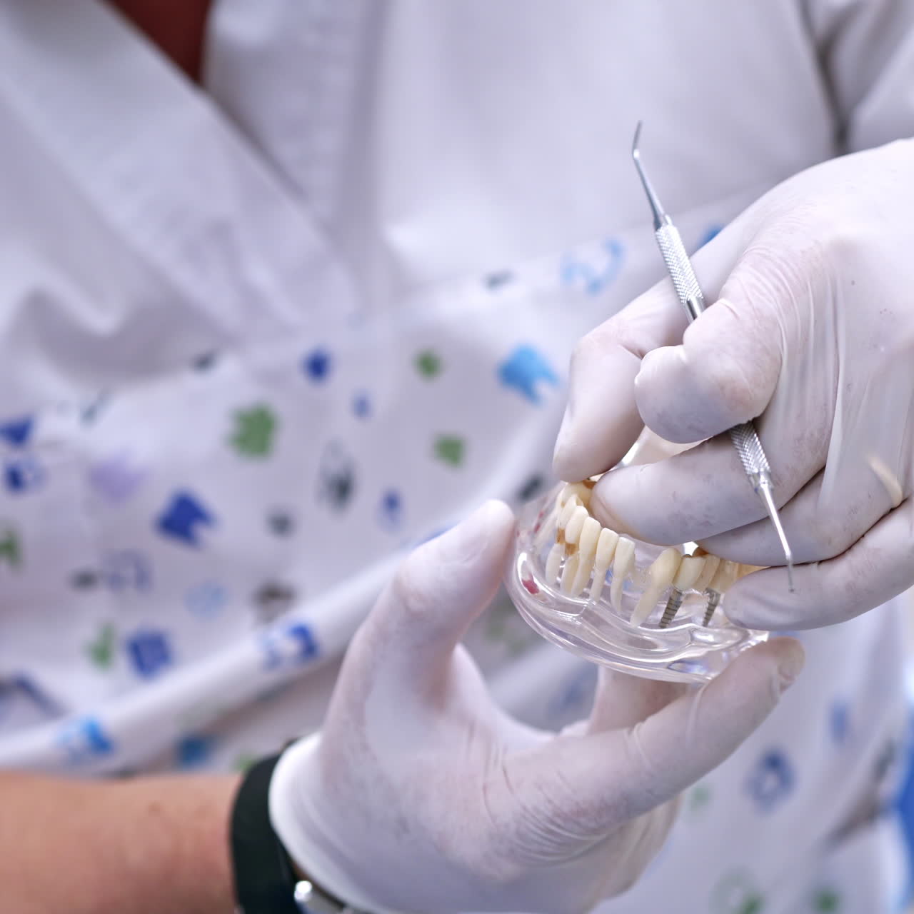 Doctor shows on a plastic jaw sample or model different methods of teeth treatment. Modern dental clinic background. Health concept. White medical gloves on male doctor's hands.