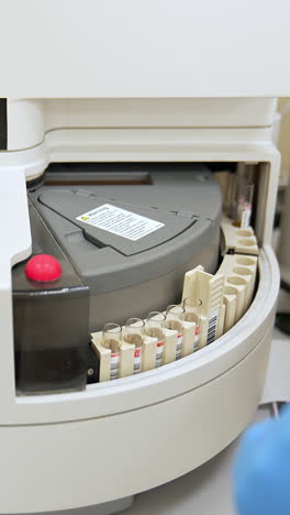 apparatus in the blood test laboratory moving the set of test tubes. equipment in the science lap. top view. vertical video