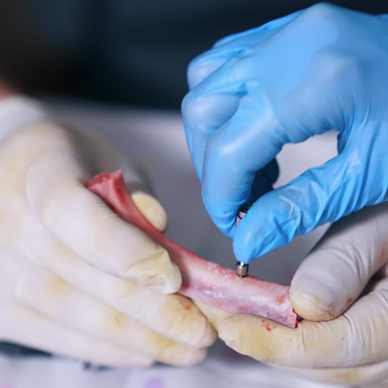 Hands in latex gloves hold a piece of bone. Hands in blue gloves attach rotating detail to a hole in bone. Close up