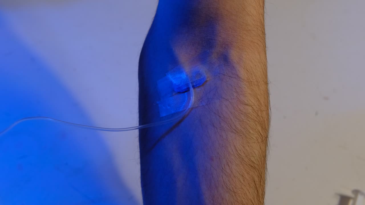 suero de unión en el brazo