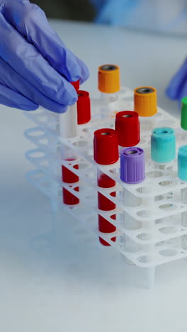medical equipment for blood test. hands of doctor holding bottles of blood