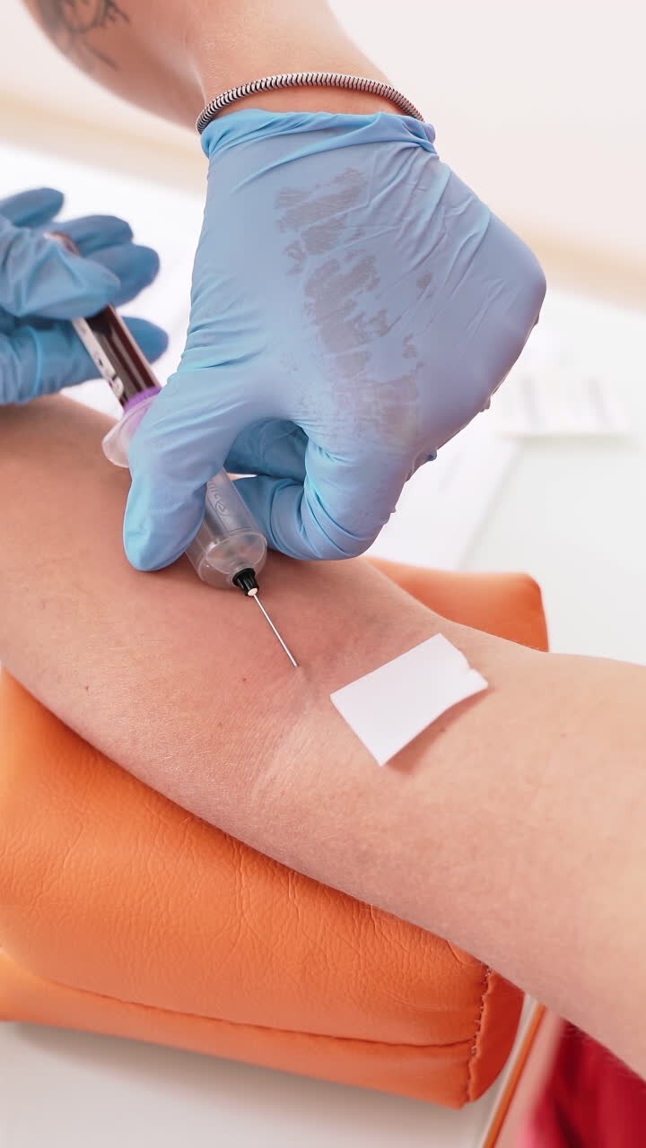 Process of taking a blood sample from vein. Hands of a nurse in blue gloves pricking a needle into a patient's vein. Medical assistant collecting blood from vein. Close-up. Vertical video