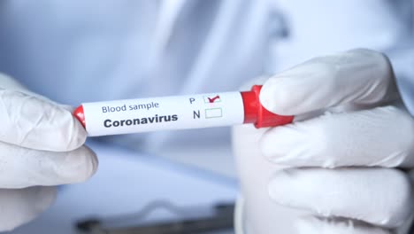 coronavirus blood sample test