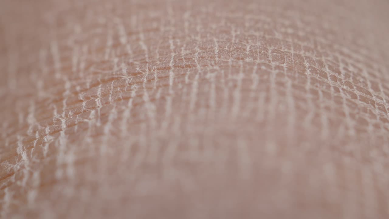 Close-up view of dry, cracked skin