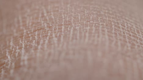 close-up view of dry, cracked skin