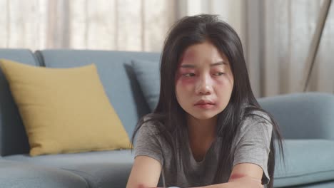 close up of young asian woman victim of violence with bruise on body sits hugging her knees being sad from physically abused at home