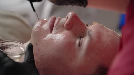 procedure voor de behandeling van het gezicht