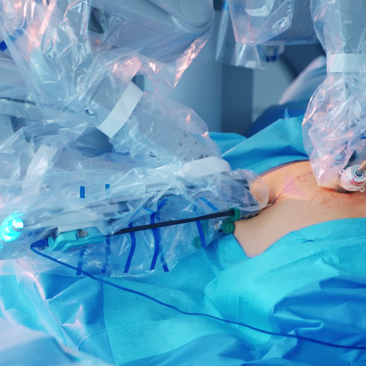 Close up of high tech surgery robot