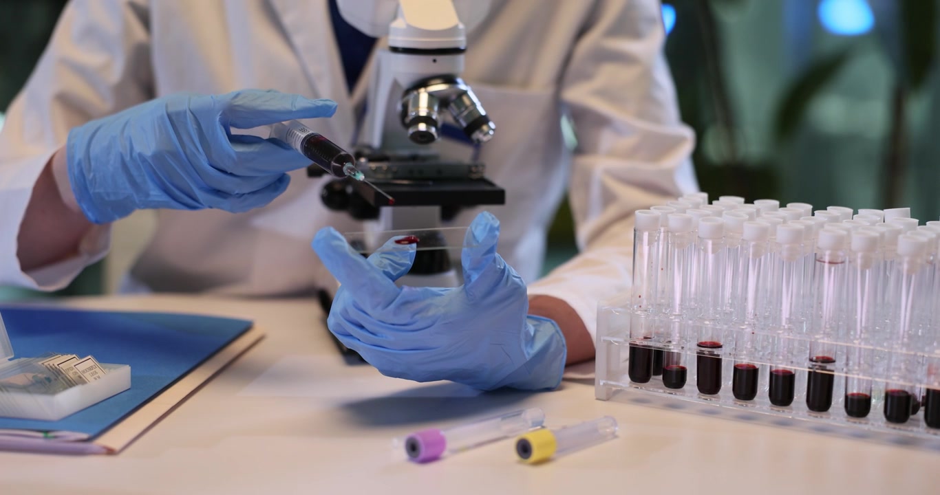 Woman medic injects blood onto glass slide with syringe in lab