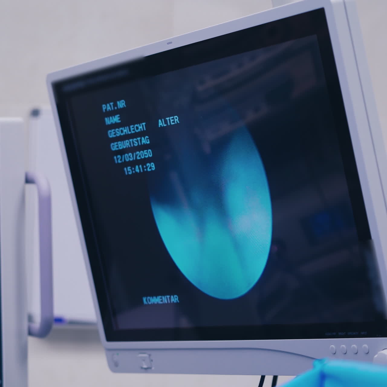 Modern equipment in the operating room. Endoscopic surgery on the screen. Display shows a laparoscopic operation.