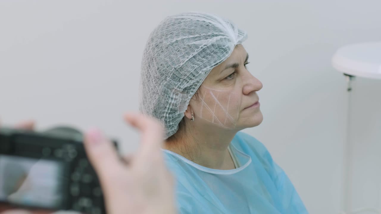 antes de los procedimientos para el rejuvenecimiento de la piel de la cara foto. cosmetología de hardware profesional
