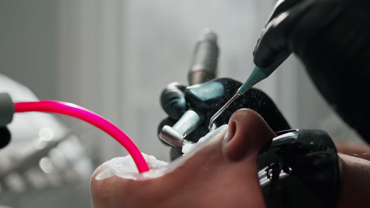 Patient in black safety glasses during tooth treatment. Stomatologist use dental instruments at treating teeth in dentist's office. Close-up.