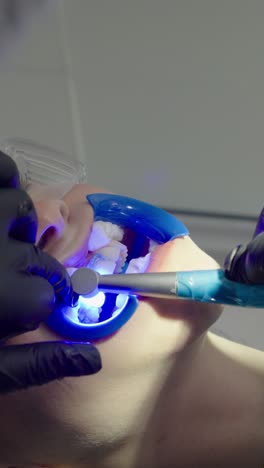 dentist applying led light activation for professional tooth whitening treatment