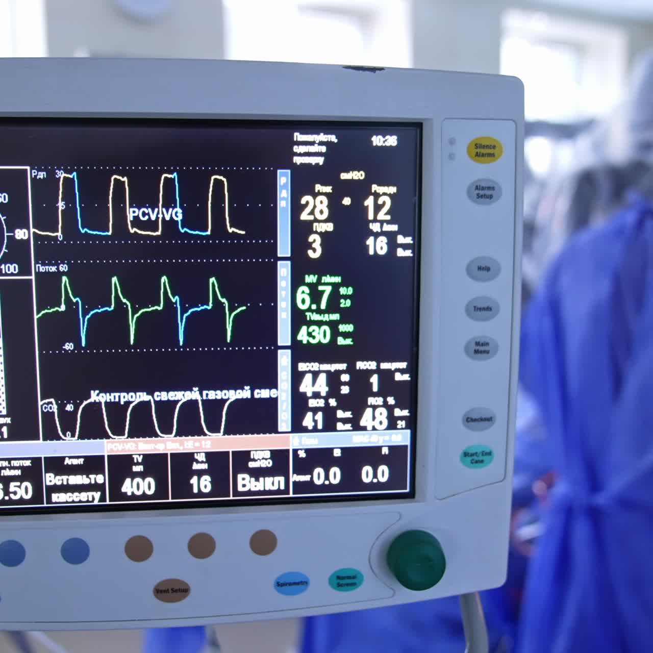 Monitor of the lung ventilating machine. Patient's life signs on the screen during the operation. Surgeon at backdrop