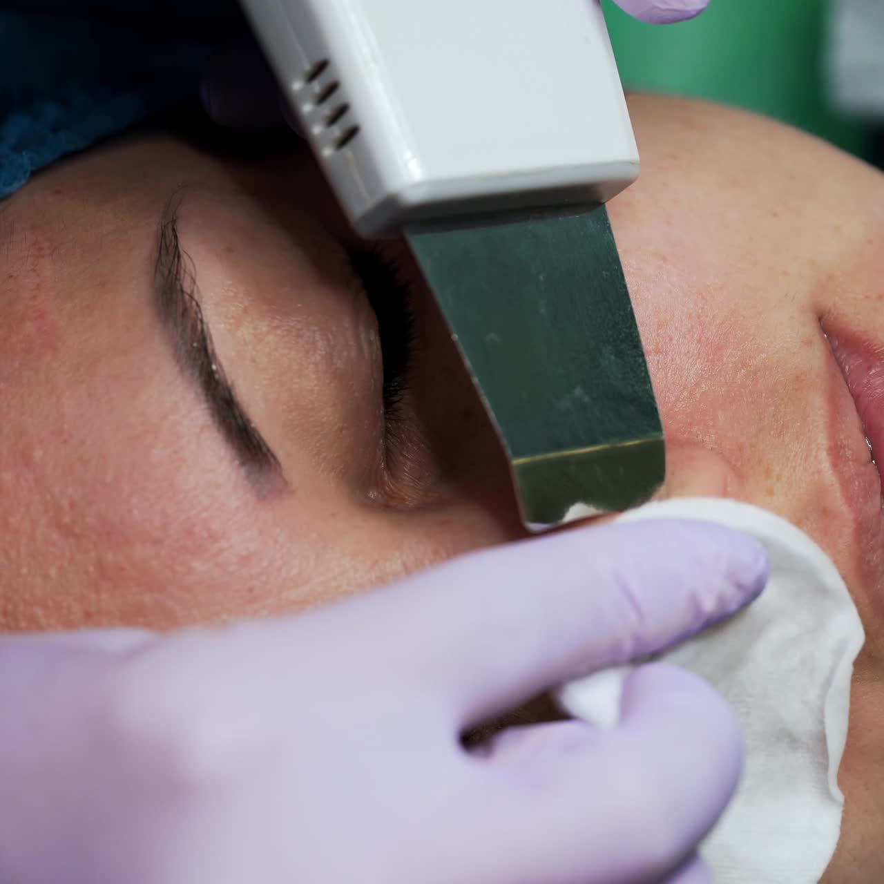 Cosmetologist's hands in white gloves use the ultrasonic device in cosmetic procedures. Scrubber is applied to clean the area around nostrils. Extreme close up