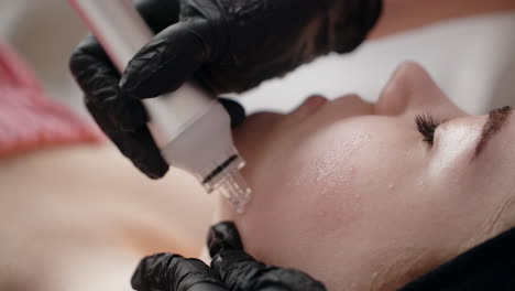 procedimiento de tratamiento facial