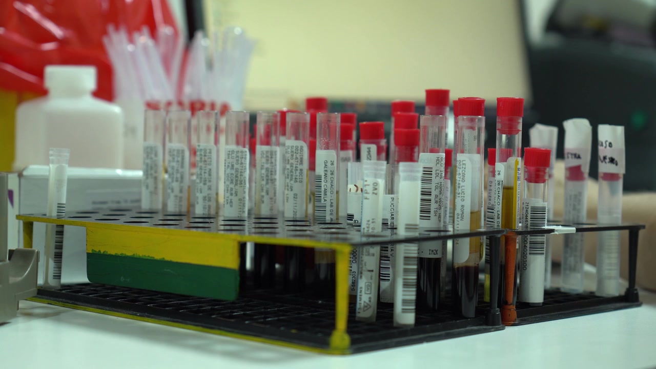 Muestras de sangre en tubos de ensayo organizadas en una gradilla dentro de un laboratorio de análisis clínicos.