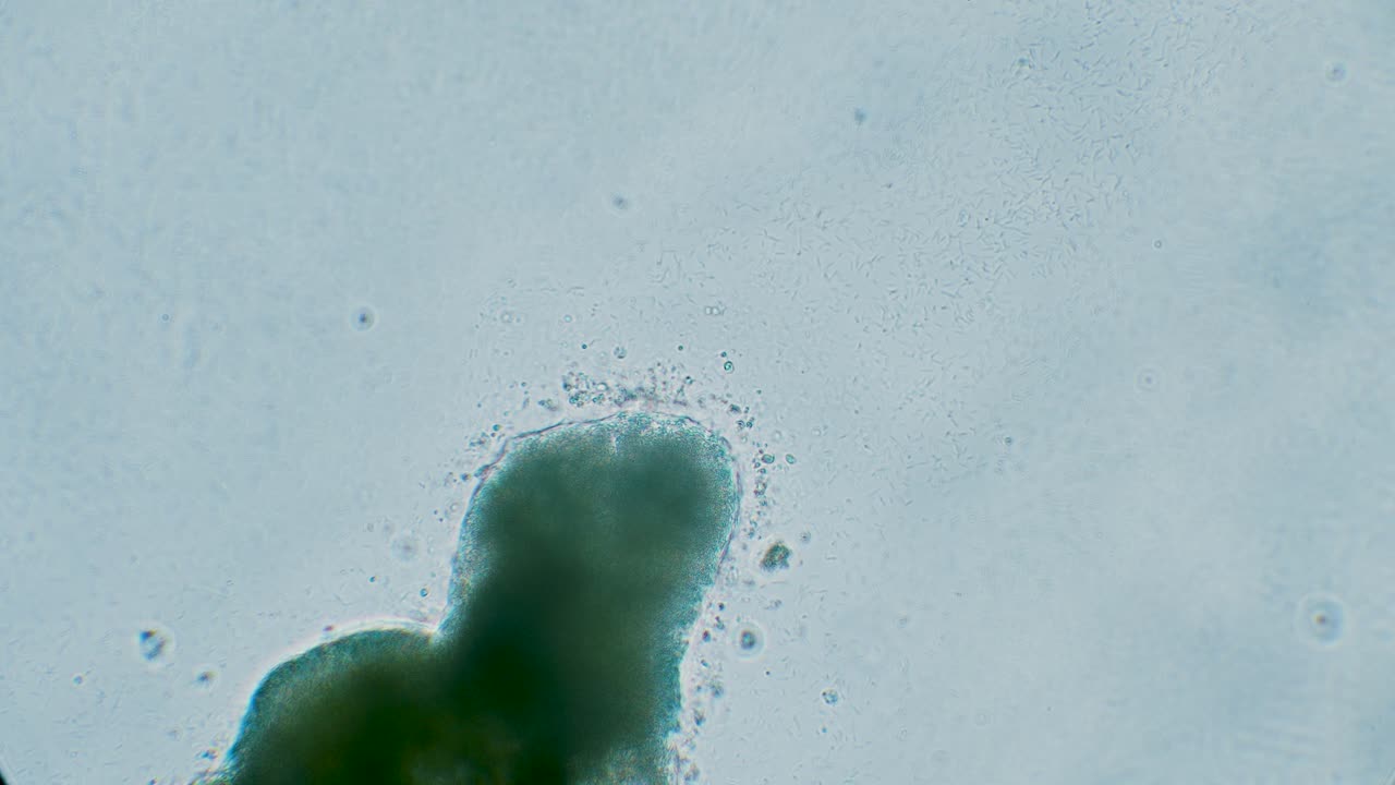 Slime mold plasmodium under microscope surrounded by bacteria