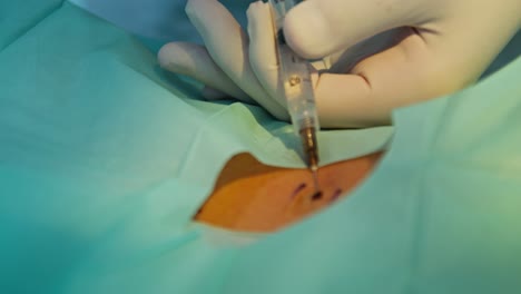 close up of a doctor with a syringe in hand