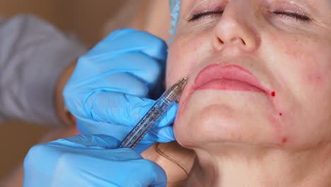 inyección facial cosmética