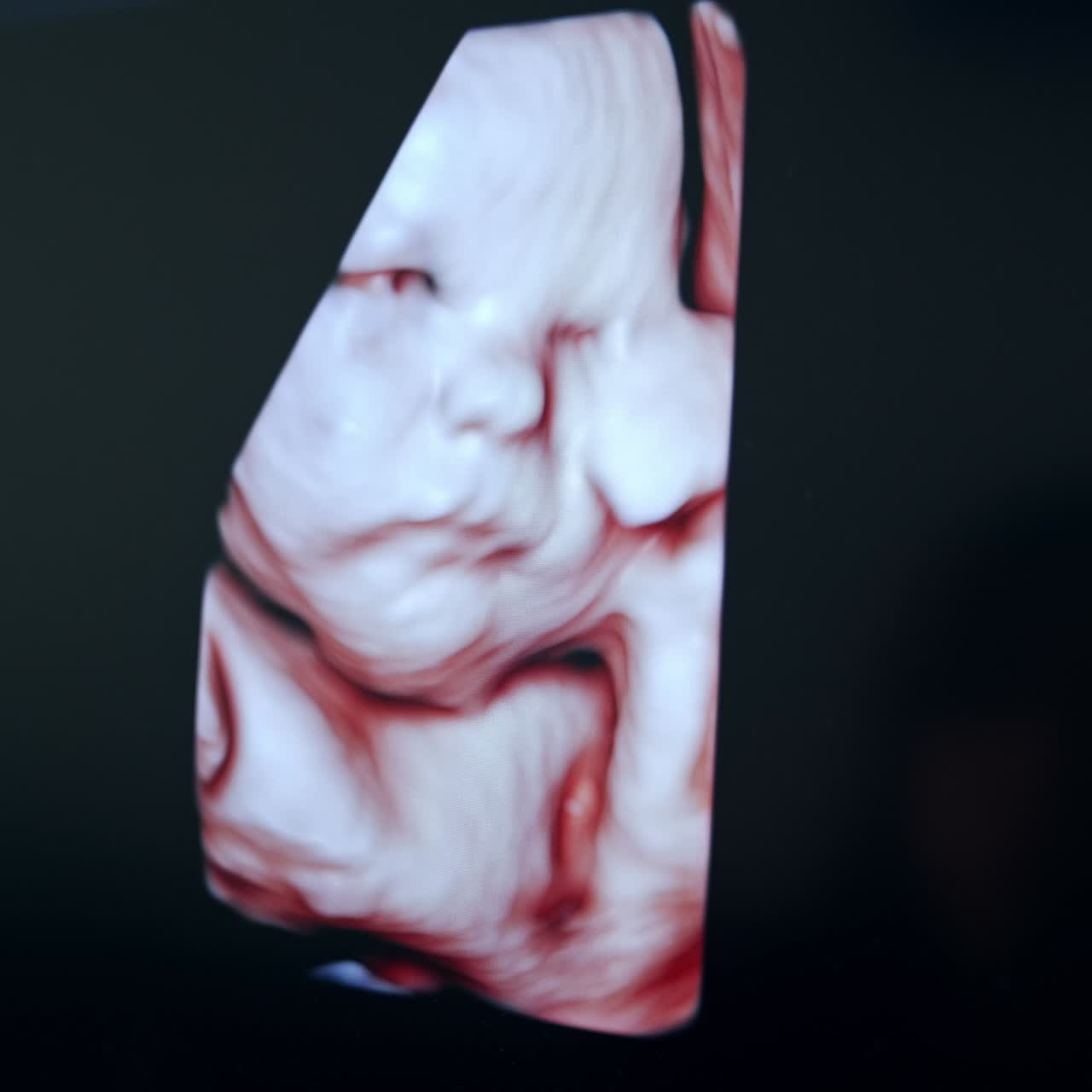 Simpatica immagine prenatale di un feto che si tiene la mano sul viso. Immagine intrauterina di un bambino sullo schermo di un ecografo