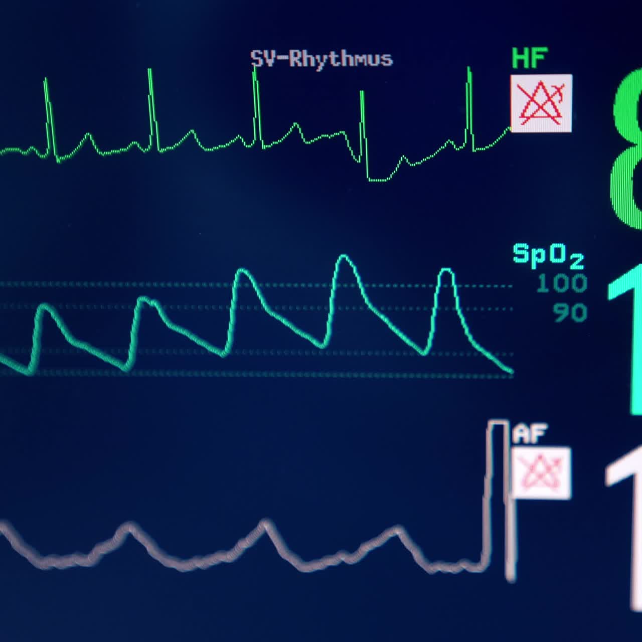 Patient's life parameters on the black screen of equipment. Monitor of lung ventilator close up