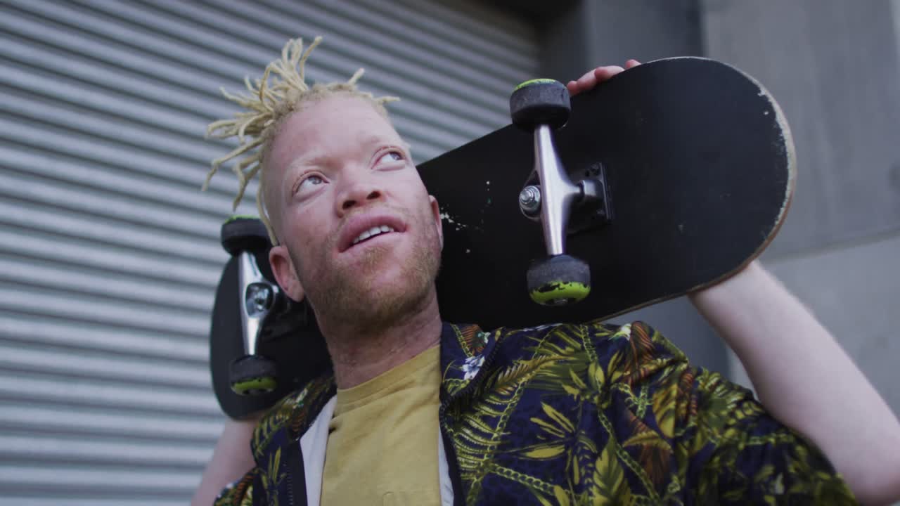 행복한 알비노 아프리카계 미국인 남자가 스케이트보드를  ⁇ 고 있다