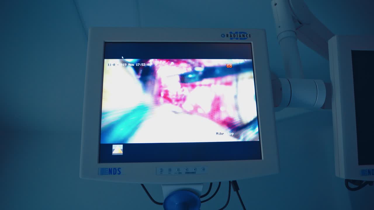 Modern equipment in the surgery room. Operation on the monitor. Process of endoscopic operation is depicted on the screen in clinic.