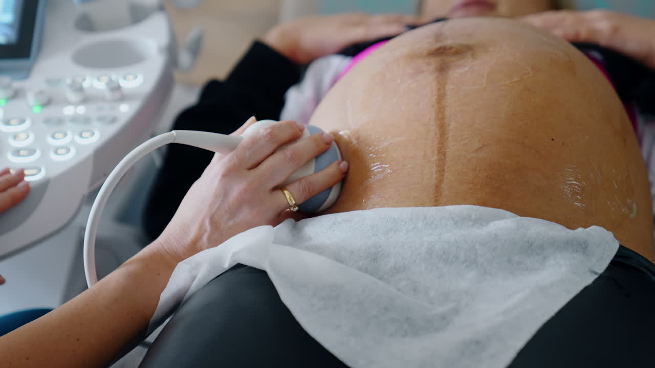 Pregnant woman is examined on the ultrasonic equipment. Medic holds the device on the big belly of a patient. Close up.