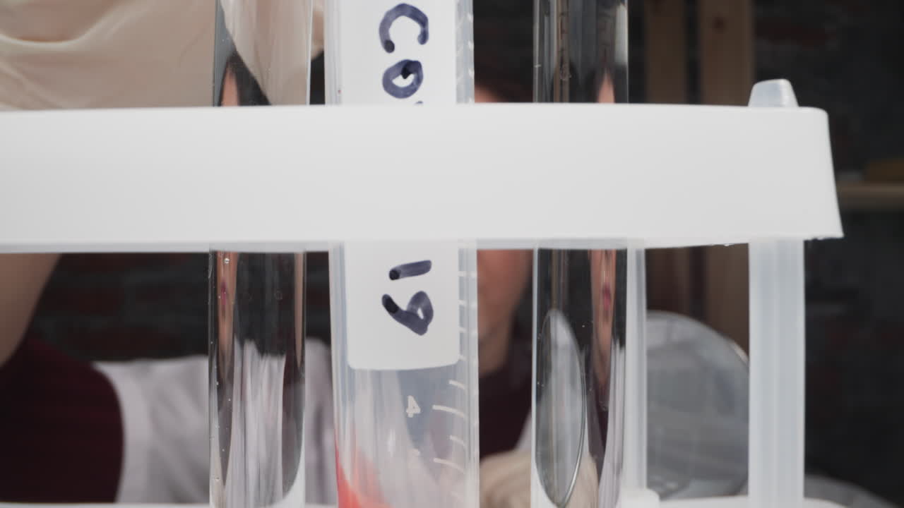 코로나19 환자의 혈액  ⁇ 플은 튜브에 담겨 있습니다.