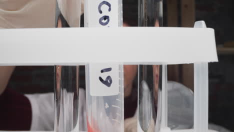 muestra de sangre del paciente de covid en un tubo en un estante contra el médico