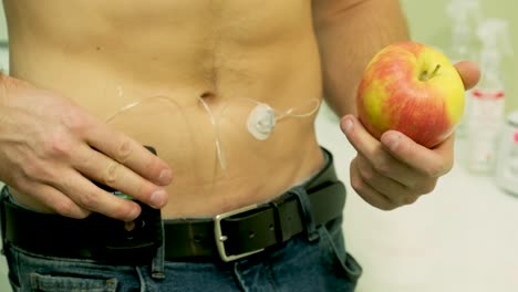 diabetic man with an insulin pump connected in his abdomen and holding the insulin pump at his hands. diabetes concept.