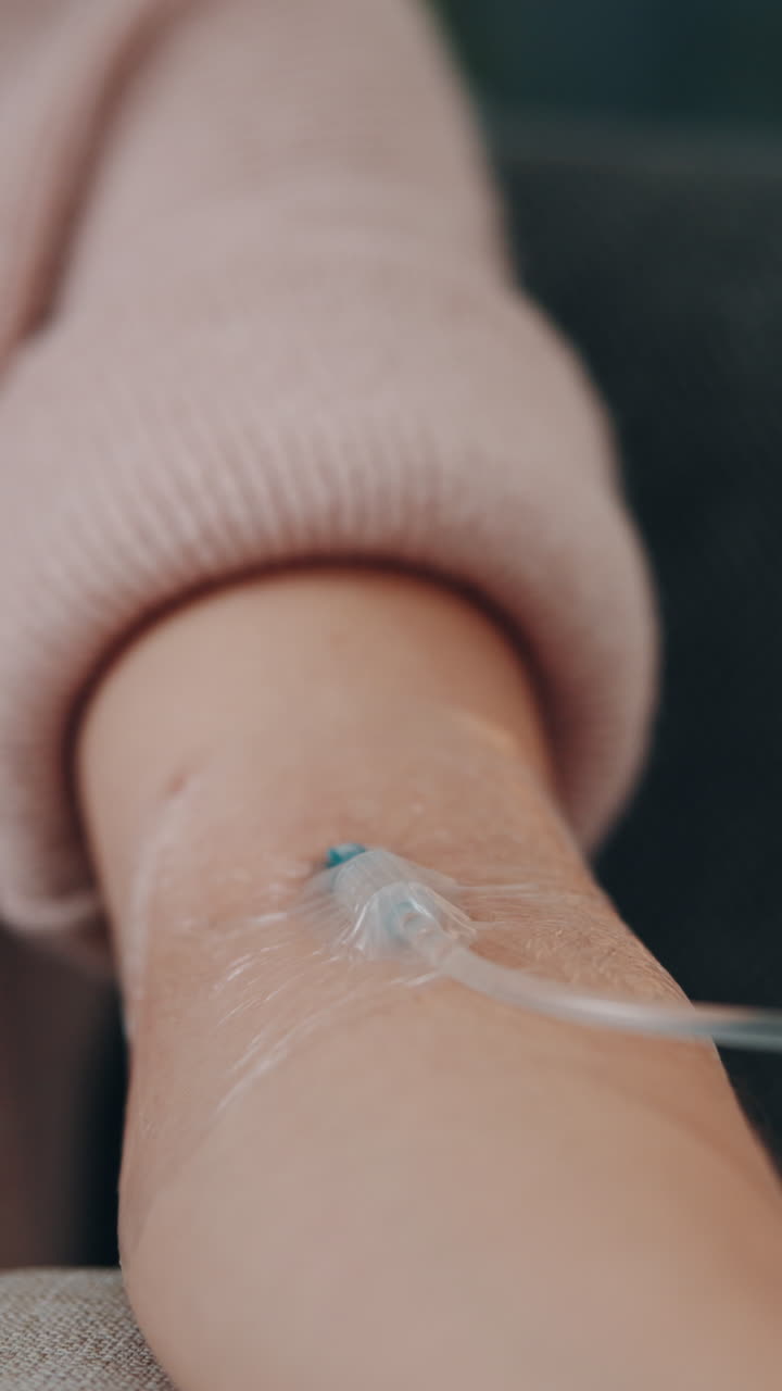 Close-up of an IV Drip in a Patient's Arm