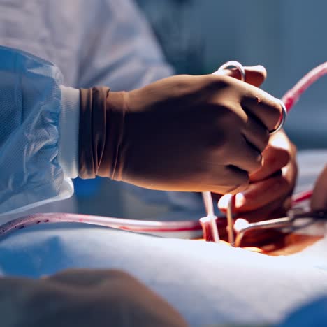 medical team performing surgical operation in modern operating room
