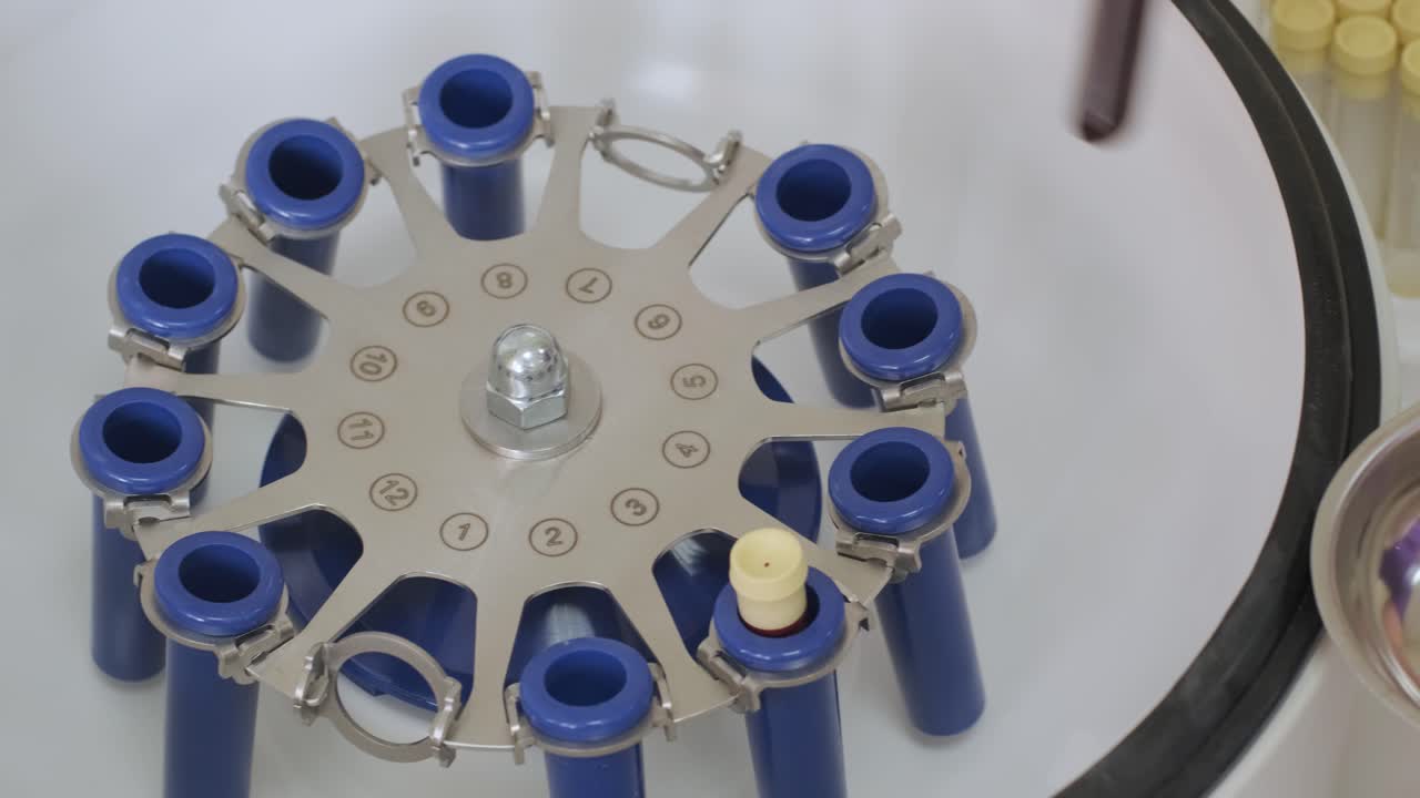 preparación de plasma rico en plaquetas. tubo con sangre en las manos. centrifugadora.