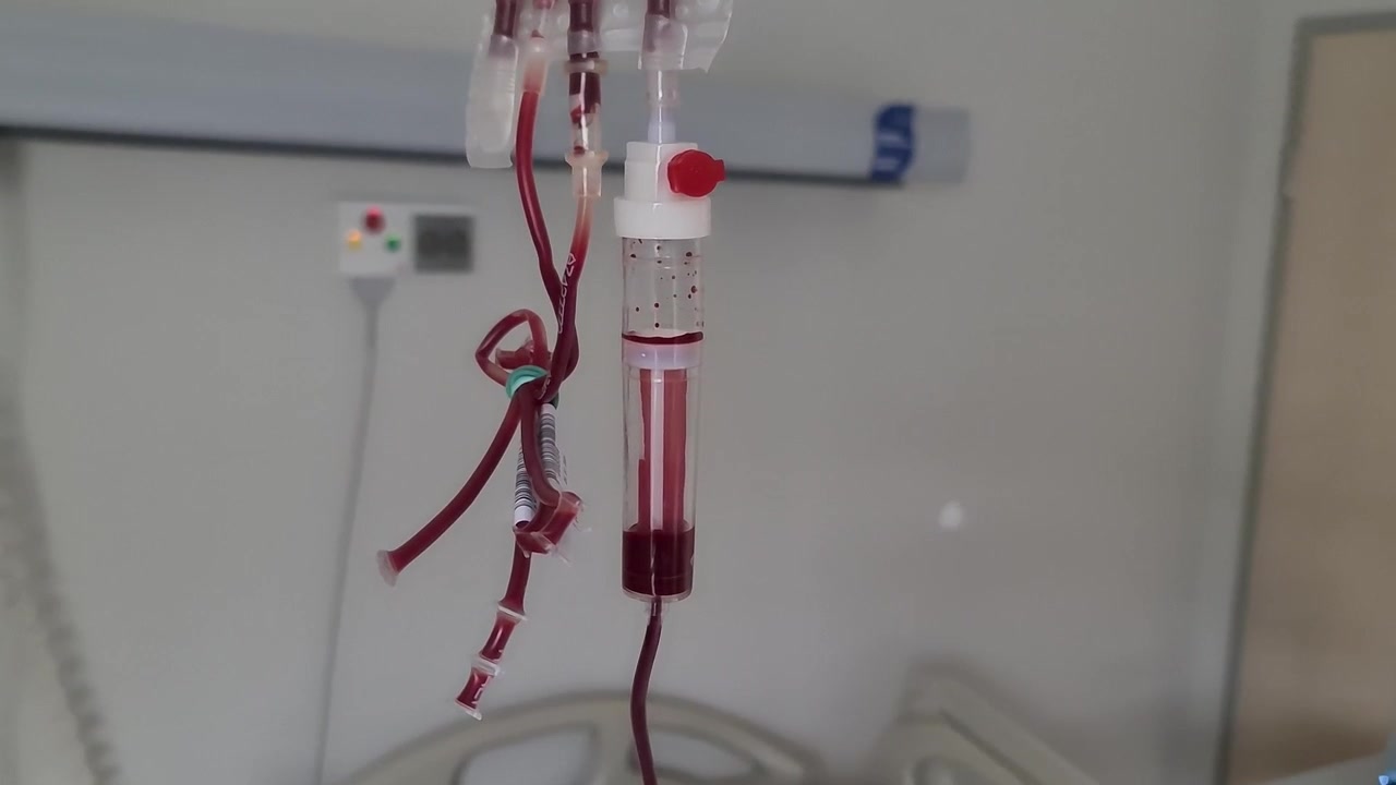 Flebo medica appesa a un supporto che somministra sangue tramite un tubicino.