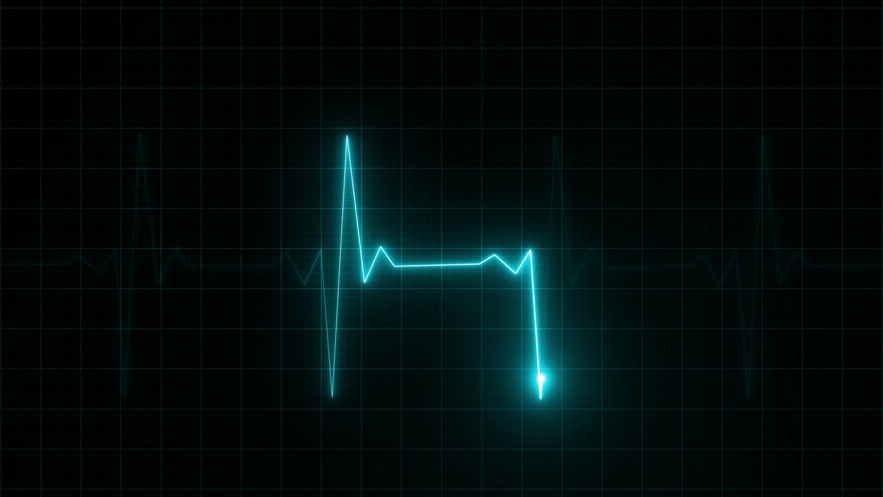Heart Rate Monitor Electrocardiogram Ekg Or Ecg Looping background