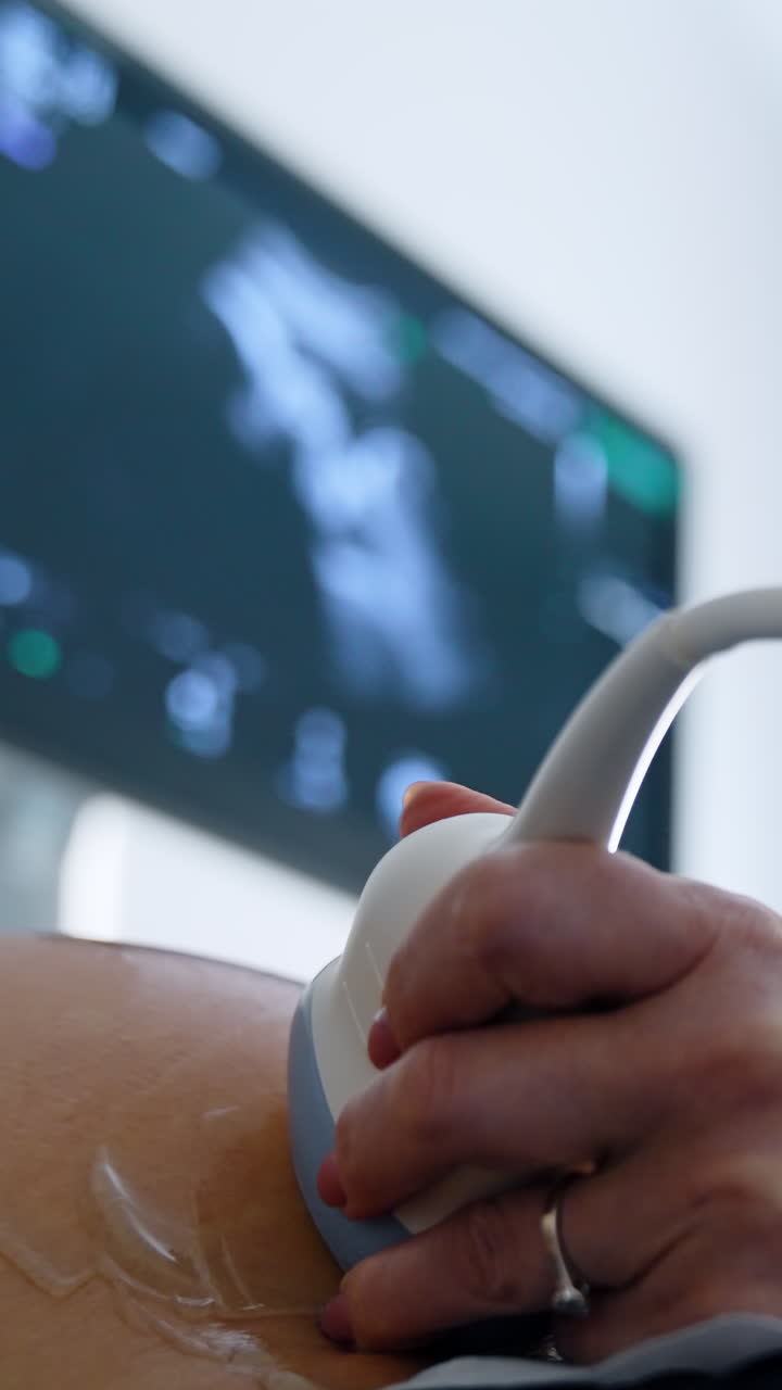 Kyiv, Ukraine, 2 May 2025: Pregnant ultrasound diagnostic. Prenatal analysis of newborn. Vertical video