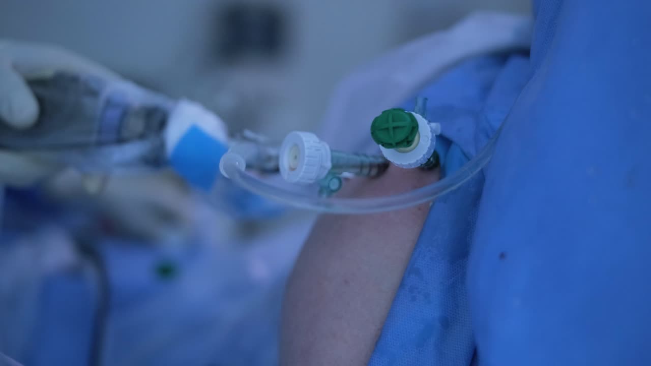 artroscopia de la articulación del hombro