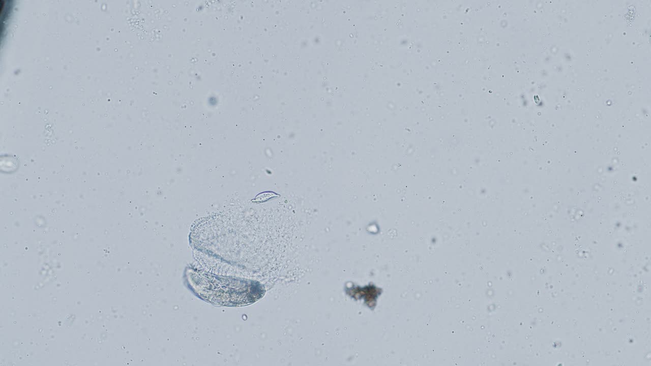 Bell-shaped ciliate vorticella under microscope in action
