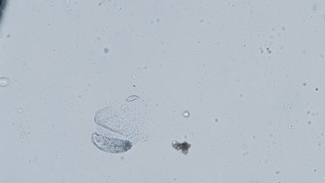 bell-shaped ciliate vorticella under microscope in action