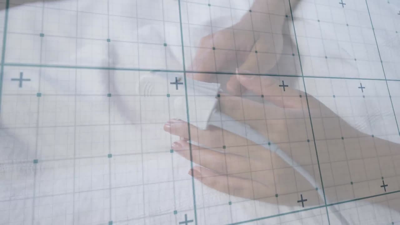 병원 침대에 있는 두 인종 환자에 대한 데이터 처리의 애니메이션