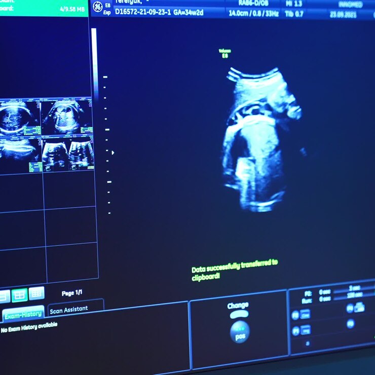 Schermata di un controllo ecografico 3D di gravidanza in clinica. Attrezzatura per ecografia. Concetto di maternità e assistenza sanitaria