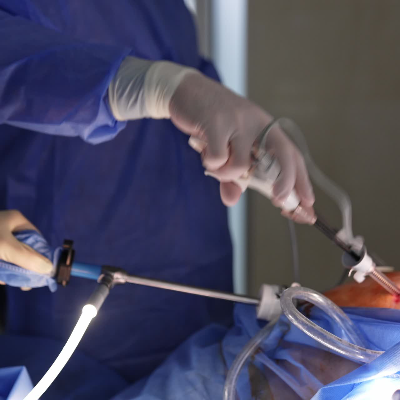 Unrecognized doctors using modern tools to perform laparoscopic operation. Hands of surgeons apply devices in procedure
