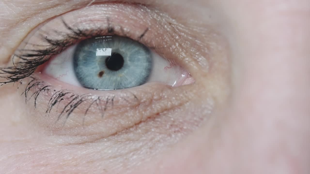 속눈썹으로 오른쪽 파란 눈을 닫습니다