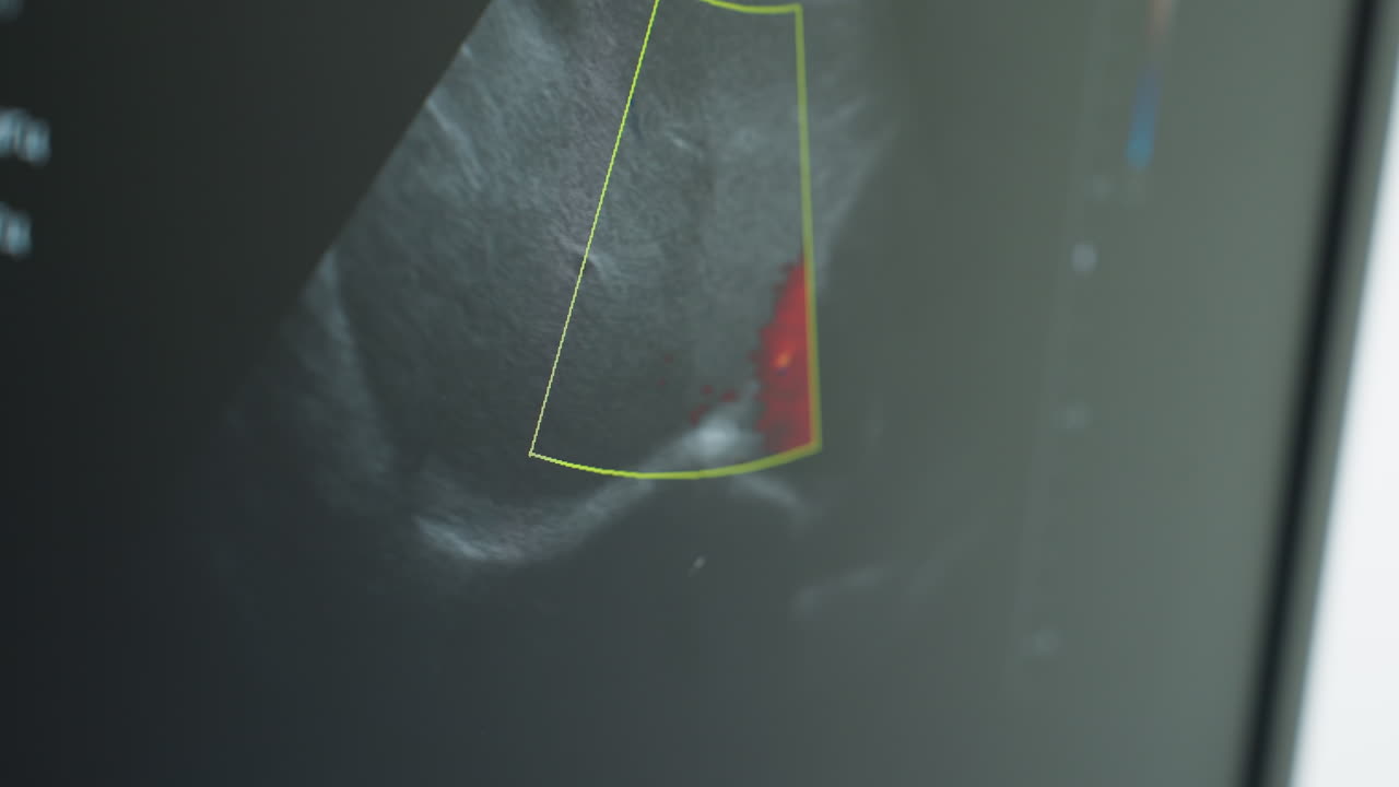 Close up of medical monitor screen displaying real time movement of internal organs and tissue during diagnostic scan procedure in clinical lab with high resolution imaging system for evaluation